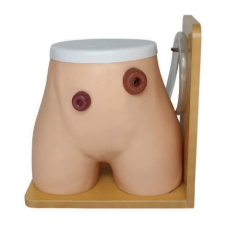 Colostomy Nursing Model